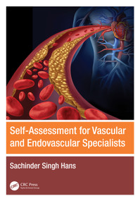 Self-Assessment for Vascular and Endovascular Specialists by Sachinder Singh Hans, 9781032485553