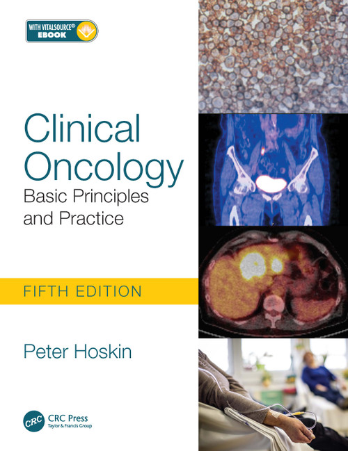 Clinical Oncology (Basic Principles and Practice) by Peter Hoskin, 9781138035553