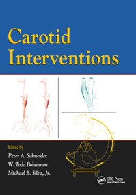 Carotid Interventions by Peter Schneider, Todd Bohannon, Michael Silva, 9780367454333