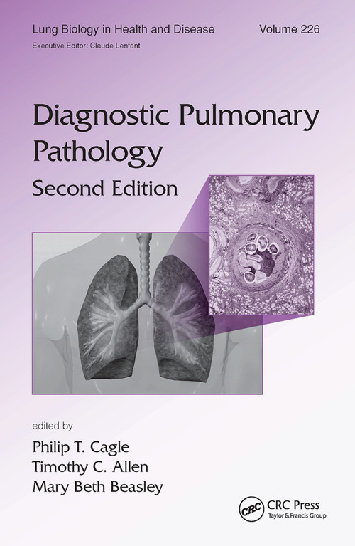 Diagnostic Pulmonary Pathology by Philip T. Cagle, Timothy C. Allen, Mary Beth Beasley, 9780367452636