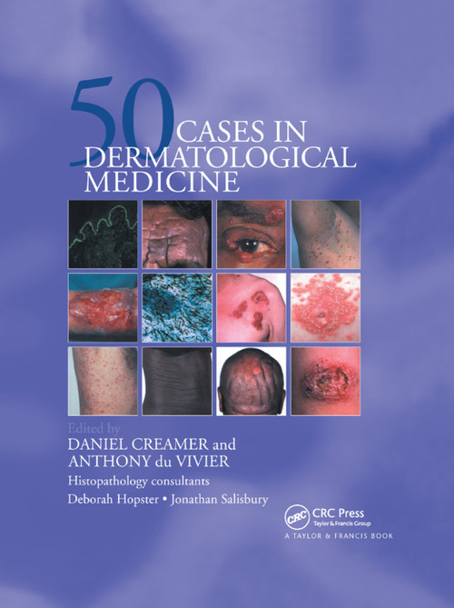Fifty Dermatological Cases by Daniel Creamer, Anthony du Vivier, 9780367393441