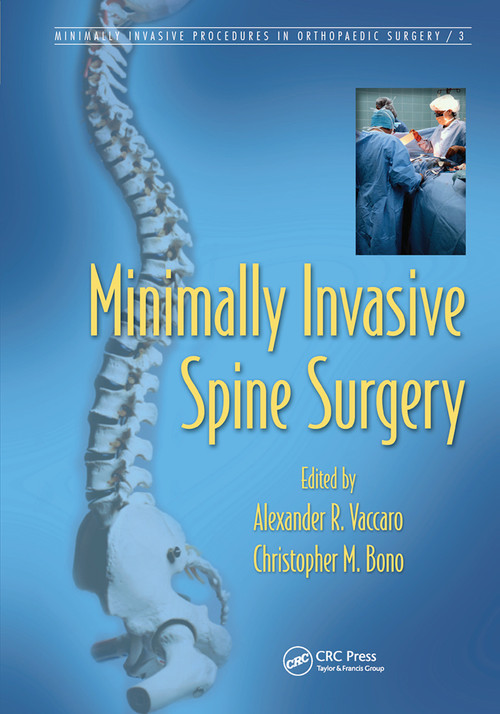 Minimally Invasive Spine Surgery by Alexander R. Vaccaro, Christopher M. Bono, 9780367453060