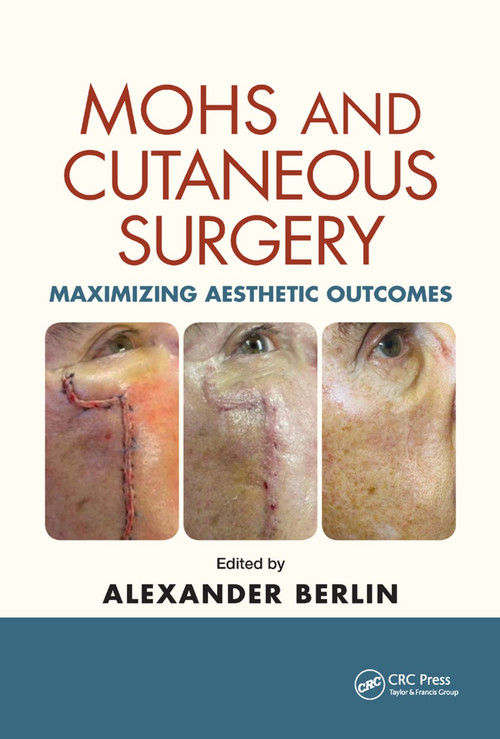 Mohs and Cutaneous Surgery (Maximizing Aesthetic Outcomes) by Alexander Berlin, 9780367378172