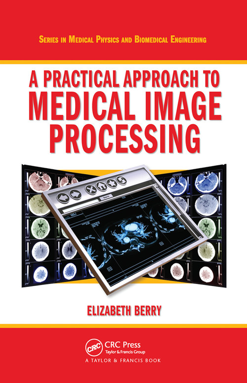A Practical Approach to Medical Image Processing by Elizabeth Berry, 9780367452841