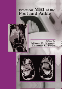 Practical MRI of the Foot and Ankle by Alison R. Spouge, Thomas L Pope, 9780367398156