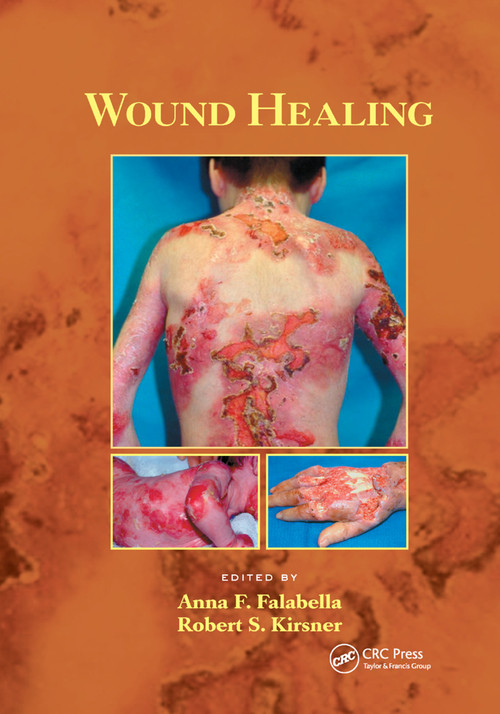 Wound Healing by Anna Falabella, Robert Kirsner, 9780367392338
