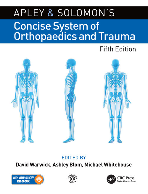 Apley and Solomon's Concise System of Orthopaedics and Trauma by David Warwick, Ashley Blom, Michael Whitehouse, 9780367198770