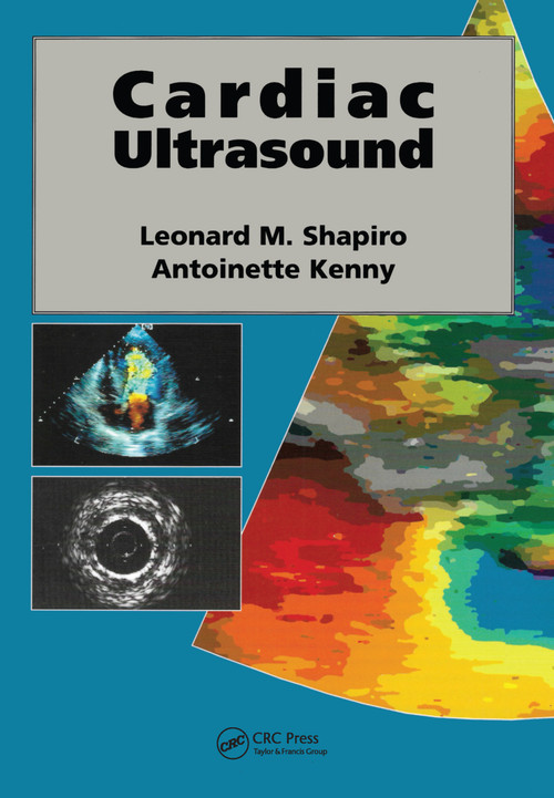 Cardiac Ultrasound by Leonard Shapiro, 9781840760231