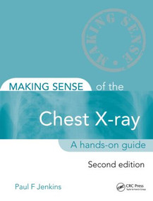 Making Sense of the Chest X-ray (A hands-on guide) by Paul Jenkins, 9781444135152