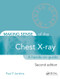 Making Sense of the Chest X-ray (A hands-on guide) by Paul Jenkins, 9781444135152