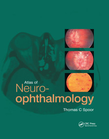 Atlas of Neuro-ophthalmology by Thomas C. Spoor, 9780367394349