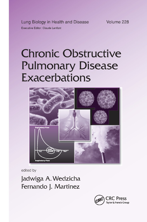 Chronic Obstructive Pulmonary Disease Exacerbations by Jadwiga A. Wedzicha, Fernando J. Martinez, 9781138372450