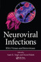 Neuroviral Infections (RNA Viruses and Retroviruses) by Sunit K. Singh, Daniel Ruzek, 9780367576530