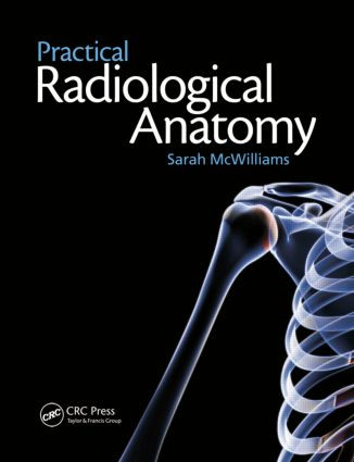 Practical Radiological Anatomy by Sarah McWilliams, 9781853158001