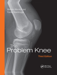 The Problem Knee by Malcolm Macnicol, Franky Steenbrugge, 9781138372467