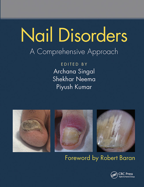 Nail Disorders (A Comprehensive Approach) by Archana Singal, Shekhar Neema, Piyush Kumar, 9780367731717