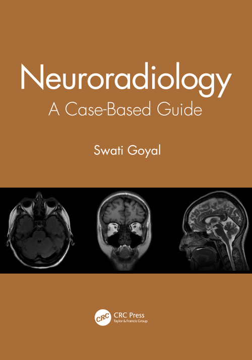 Neuroradiology (A Case-Based Guide) by Swati Goyal, 9780367903190