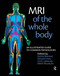 MRI of the Whole Body (An Illustrated Guide for Common Pathologies) by Nikhil Bhuskute, Edward Hoey, Amit Lakkaraju, Kshitij Mankad, 9781853157769