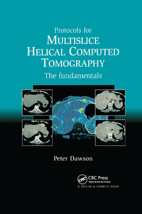 Protocols for Multislice Helical Computed Tomography (The Fundamentals) by Dawson Peter, 9780367391201