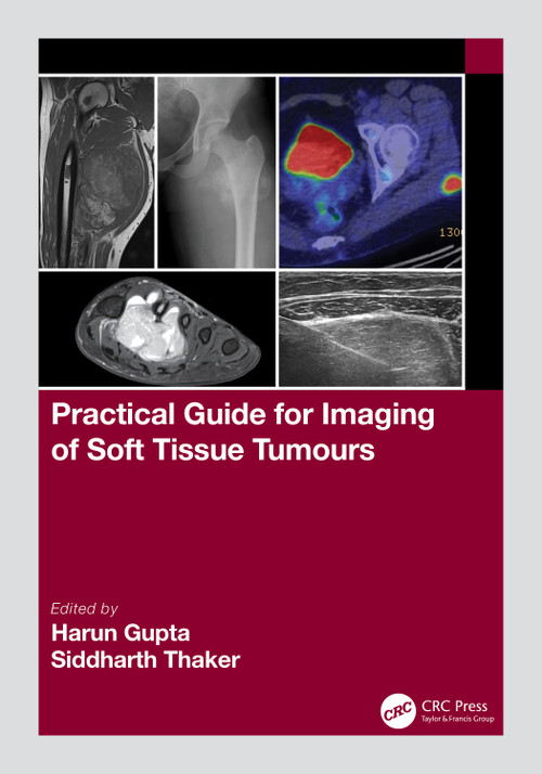 Practical Guide for Imaging of Soft Tissue Tumours by Harun Gupta, Siddharth Thaker, 9781032111759