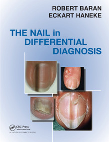Nail in Differential Diagnosis by Robert Baran, Eckart Haneke, 9780367389741