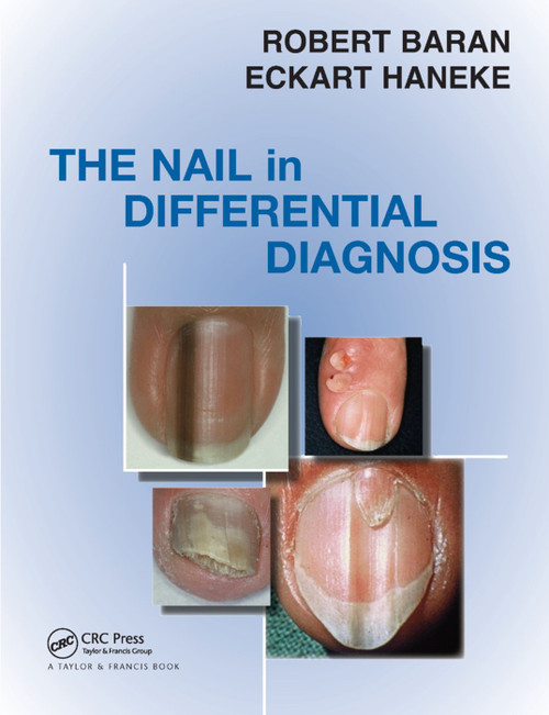Nail in Differential Diagnosis by Robert Baran, Eckart Haneke, 9780367389741