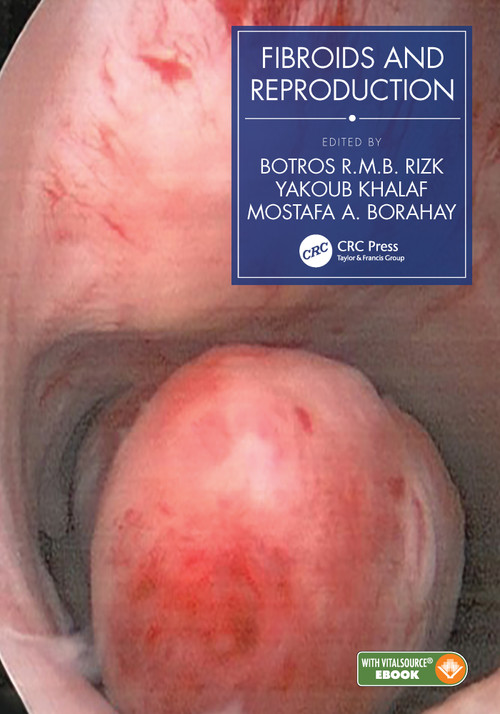 Fibroids and Reproduction by Botros R.M.B. Rizk, Yakoub Khalaf, Mostafa A. Borahay, 9780367550677