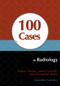 100 Cases in Radiology by Robert Thomas, James Connelly, Christopher Burke, 9781444123319