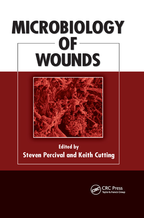 Microbiology of Wounds by Steven Percival, Keith Cutting, 9780367384203