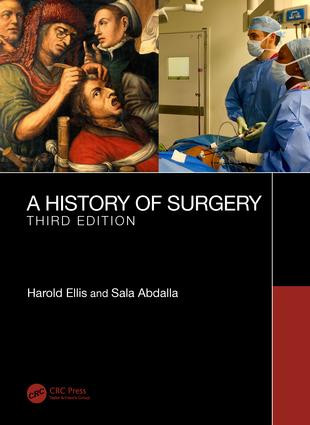 A History of Surgery (Third Edition) by Harold Ellis, Sala Abdalla, 9781138617391