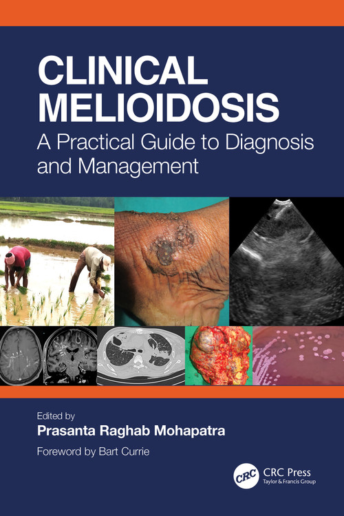 Clinical Melioidosis (A Practical Guide to Diagnosis and Management) by Prasanta Raghab Mohapatra, 9781032348278