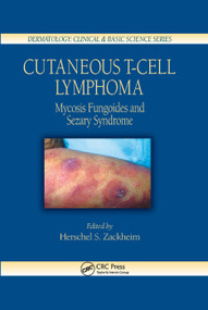 Cutaneous T-Cell Lymphoma (Mycosis Fungoides and Sezary Syndrome) by Herschel S. Zackheim, 9780367393670