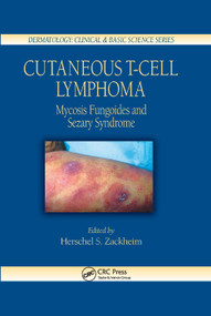 Cutaneous T-Cell Lymphoma (Mycosis Fungoides and Sezary Syndrome) by Herschel S. Zackheim, 9780367393670