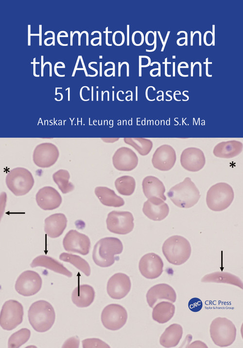Haematology and the Asian Patient (51 Clinical Cases) by Anskar Y.H. Leung, Edmond S K Ma, 9781032351254