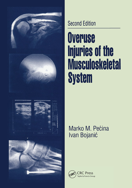 Overuse Injuries of the Musculoskeletal System by Marko M. Pecina, Ivan Bojanic, 9780367446680