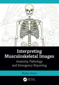 Interpreting Musculoskeletal Images (Anatomy, Pathology and Emergency Reporting) by Rosie Jones, 9781032398914