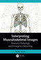 Interpreting Musculoskeletal Images (Anatomy, Pathology and Emergency Reporting) by Rosie Jones, 9781032398914