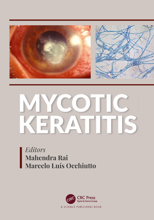 Mycotic Keratitis by Mahendra Rai, Marcelo Luis Occhiutto, 9780367779382