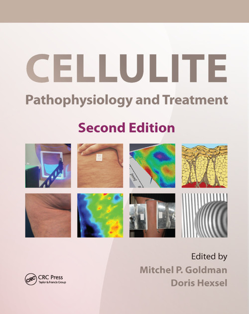 Cellulite (Pathophysiology and Treatment) by Mitchel P. Goldman, Doris Hexsel, 9780367384180