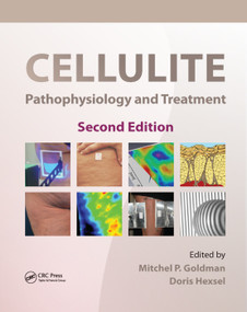 Cellulite (Pathophysiology and Treatment) by Mitchel P. Goldman, Doris Hexsel, 9780367384180