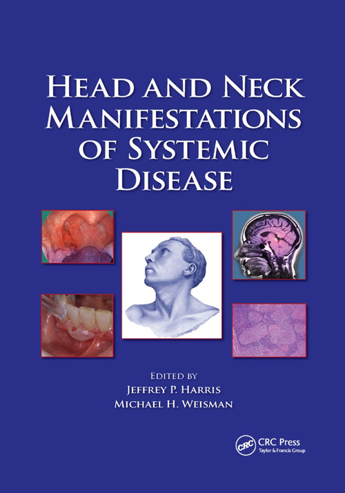Head and Neck Manifestations of Systemic Disease by Jeffrey P. Harris, Michael H. Weisman, 9780367388805