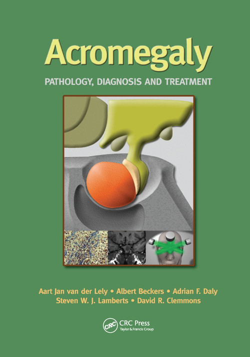 Acromegaly (Pathology, Diagnosis and Treatment) by Aart Jan van der Lely, Albert Beckers, Adrian Daly, Steven W. Lamberts, David R. Clemmons, 9780367392581