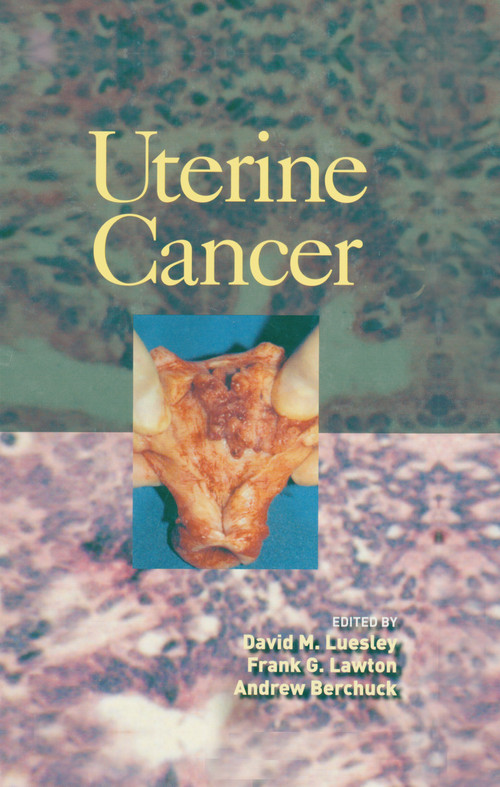 Uterine Cancer by David M. Luesley, Frank Lawton, Andrew Berchuck, 9780824759513