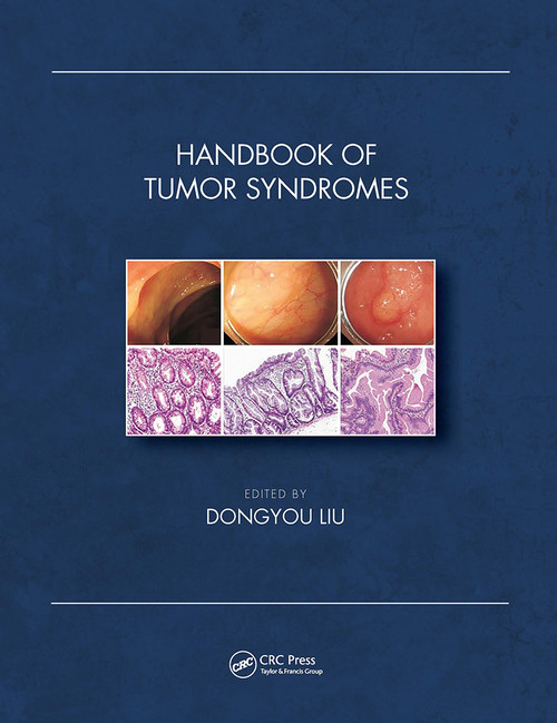 Handbook of Tumor Syndromes by Dongyou Liu, 9781032400044