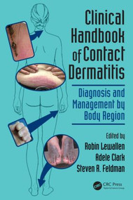 Clinical Handbook of Contact Dermatitis (Diagnosis and Management by Body Region) by Robin Lewallen, Adele Clark, Steven R. Feldman, 9781482237177