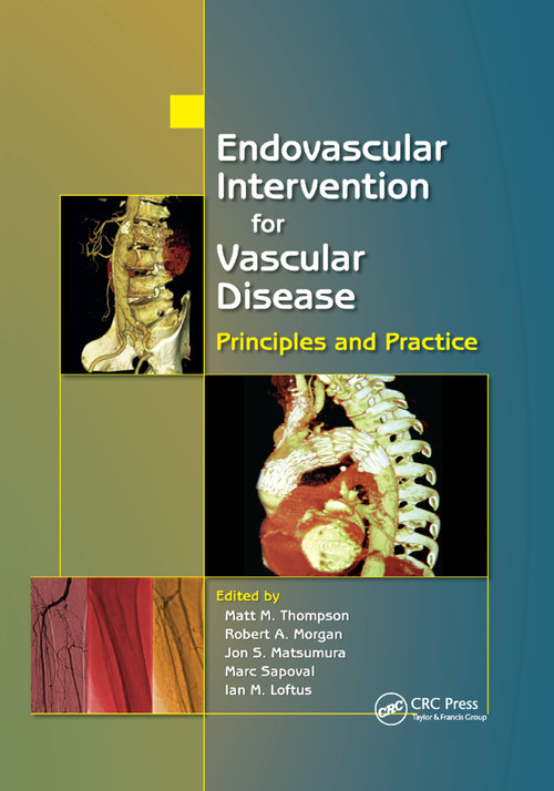 Endovascular Intervention for Vascular Disease (Principles and Practice) by Matt M. Thompson, Robert A. Morgan, Jon S. Matsumura, Marc Sapoval, Ian M. Loftus, 9780367387907