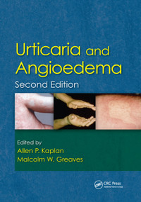 Urticaria and Angioedema by Allen Kaplan, Malcolm W. Greaves, 9780367385941