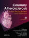 Coronary Atherosclerosis (Current Management and Treatment) by Chourmouzios Arampatzis, Eugene McFadden, Lampros Michalis, Renu Virmani, Patrick W. Serruys, 9780367576691