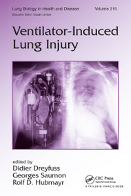 Ventilator-Induced Lung Injury by Didier Dreyfuss, Georges Saumon, Rolf Hubmayr, 9780849337161