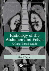 Radiology of the Abdomen and Pelvis (A Case-Based Guide) by Swati Goyal, 9781032587745